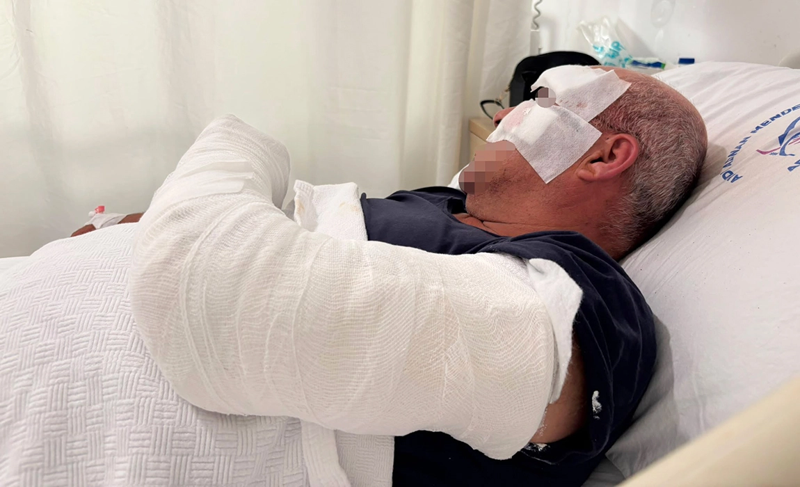 Motosiklet kazasında yaralandı, kardeşinin &ccedil;arptığını iddia etti