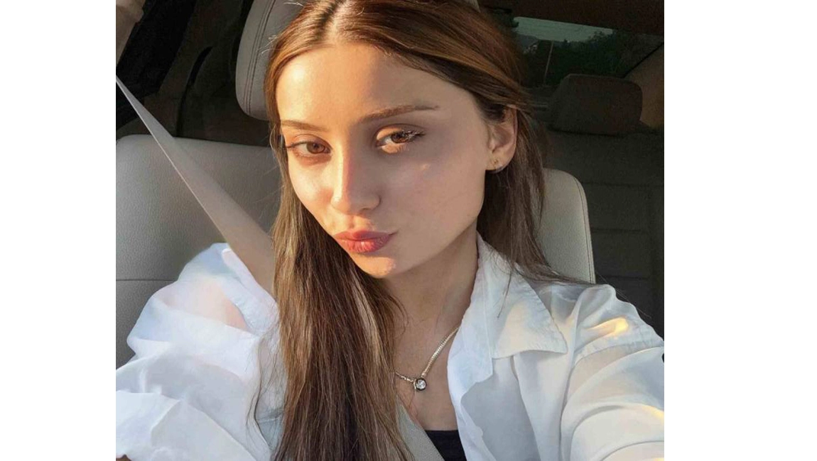 YEMEK YERKEN BACAĞINA YORGUN MERMİ İSABET ETTİ